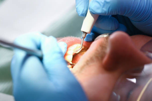Best Urgent Dental Care for Toothache in Jasper, IN