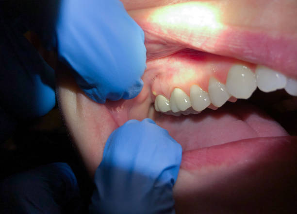 Best Emergency Dentist for Special Needs Patients in Jasper, IN